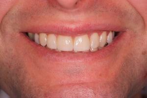 Førende inden for tandfacader – TandCity