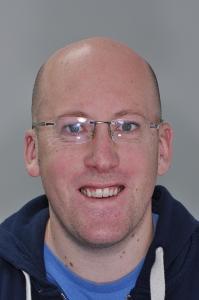 Før behandling Smile Design – TandCity